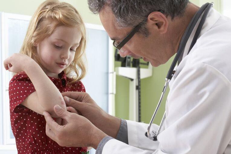 doctor examining child with psoriasis