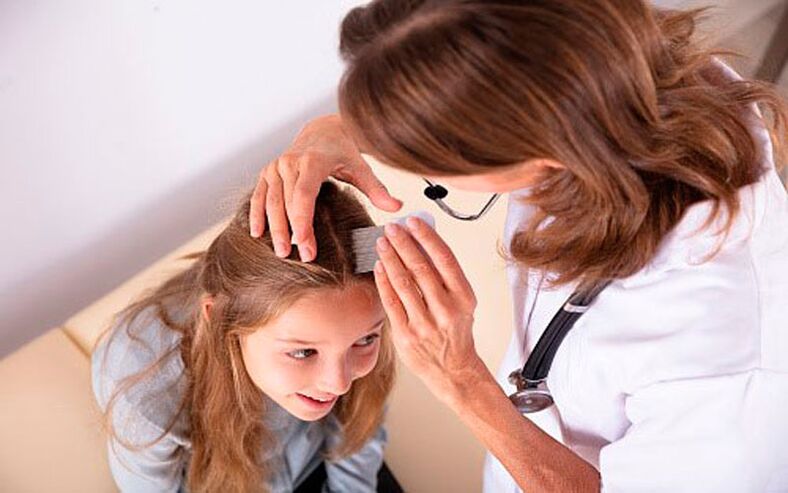 treatment of cranial psoriasis in children